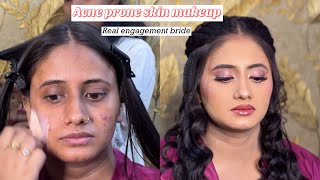 Acne prone skin makeup  Engagement makeup tutorial on oily skin  Real work  Tips for Active acne [upl. by Ecirad]