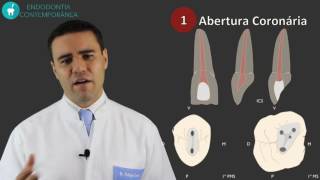 Preparo do Canal Radicular Com Segurança E Qualidade Em 5 Passos [upl. by Drescher616]