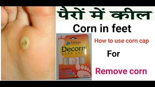 Corn removal under feet Hindicorn caps use karne ka tarika hindi Review [upl. by Olive]