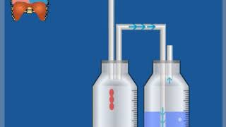 2KammerSystem ohne Sog – Funktionsweise  Thoraxdrainage für Einsteiger [upl. by Bainbridge]