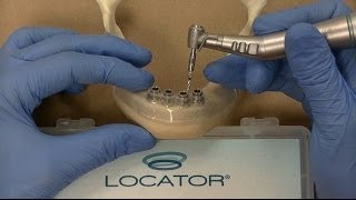 Zest LODI Mandibular Guided Surgery Demonstration  Technique [upl. by Argus225]