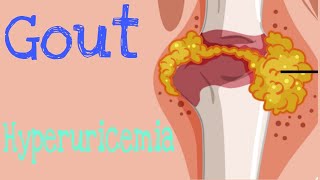 Gout  Hyperuricemia  Causes and Treatment  Lecture 7 [upl. by Radnaskela743]