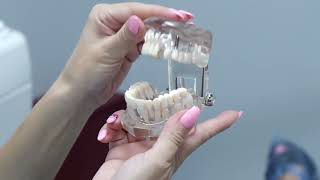 The Importance of Lower Partial Dentures [upl. by Abas997]