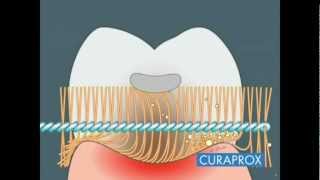 Interdental Care  How To [upl. by Hadihsar]