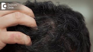 What are the causes of a sensitive and painful scalp  Dr Amee Daxini [upl. by Blanchette]