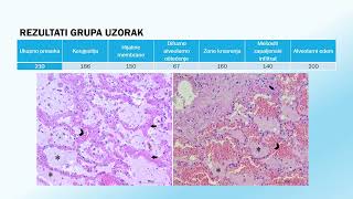 Doktorat  Jelena Kuzmanović  Uloga interleukina 6 8 i 18 u patogenezi akutnog respiratornog [upl. by Onavlis398]