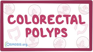 Colorectal polyps  an Osmosis Preview [upl. by Cindi]