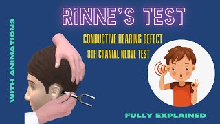 Rinne test conductive deafness and air amp bone conduction  8th cranial nerve CNS examination [upl. by Wernda]