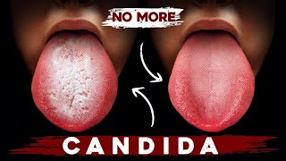 A Better Way to Eliminate Candida for Good [upl. by Ikik490]