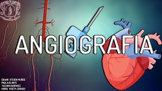 ANGIOGRAFIA  procedimiento  Tipos  Efectos secundarios [upl. by Nodnek]