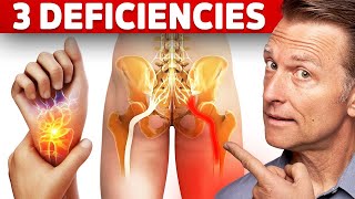 The 3 Vitamin Deficiencies in Sciatica and Carpal Tunnel Syndrome [upl. by Jedlicka]