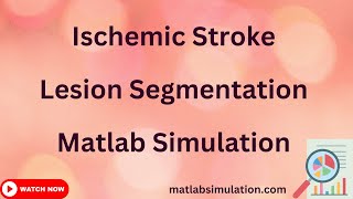 Ischemic Stroke Lesion Segmentation Matlab Simulation [upl. by Malinowski]