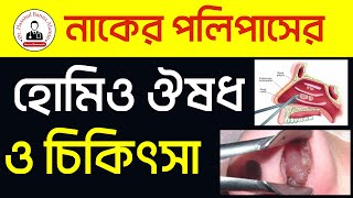 নাকের পলিপাসের হোমিওপ্যাথিক ঔষধ চিকিৎসা নাকের পলিপাসের হোমিও ঔষধ চিকিৎসা স্যাঙ্গুনেরিয়া নাইট থুজা [upl. by Alit]