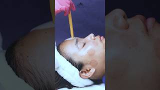 skincare skintreatment skincareroutine chennai bangalore bengaluru viral youtubeshorts shot [upl. by Aneerbas]