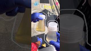 URINE TEST  biochemistry experiment🧪  dentist dentalstudent ytshorts [upl. by Adehsor640]