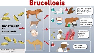 Brucellosis  Richard Oehler MD [upl. by Eilatam]