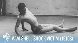 World War 1 Shell Shock Victim Recovery 1910s  War Archives [upl. by Elnukeda]