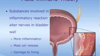 Understanding Interstitial Cystitis IC [upl. by Fanchon540]