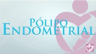 Pólipo Endometrial  Dr Giuliano Bedoschi [upl. by Meter]