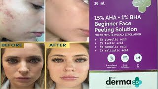 derma co 15 AHA 1BHA beginner face peeling solution face peeling serum face peeling at home [upl. by Trev]