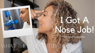 What They Dont Tell You About Rhinoplasty  My Experience amp Recovery With My Nose Job [upl. by Dumm878]