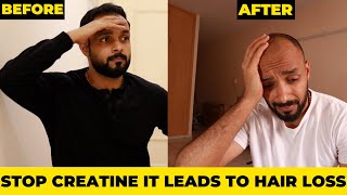 Creatine Does it Cause Hair Loss 👨‍🦲 Creatine Exposed hairloss [upl. by Assetniuq]