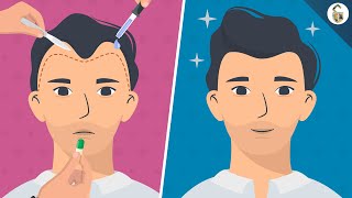 Hair Loss Treatments For Men According To Science [upl. by Ciapas648]