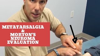 Metatarsalgia and Mortons Neuroma Evaluation and Treatment [upl. by Ylsew]