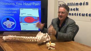 The One Exercise You Never Want To Do When You Have A Herniated Disc Herniated Disc Treatment [upl. by Adelia]