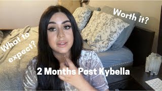 2 Months Post Kybella  What is the KYBELLA experience like [upl. by Jadwiga]