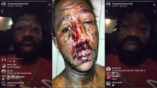 Boskoe100 Explains He Was Shot In The Face Responds to Young Thug InstagramLIVE [upl. by Cai]