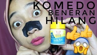 CARA AMPUH PENGHILANG KOMEDO Pore pack  Baking Soda [upl. by Poppo614]