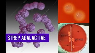 Streptococcus Agalactiae Bacteria  Complete Overview [upl. by Nhar]