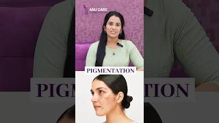 Pigmentation Causes amp Different Types Revealed skincare pigmentation melasma [upl. by Fletcher]