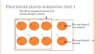 Widal amp Rose bengal test [upl. by Nelyak]