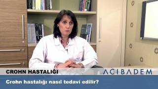 Crohn hastalığı nasıl tedavi edilir [upl. by Alesig]