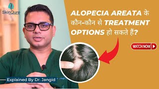 What are the Treatment Options for Alopecia Areata  Hair Transplant Surgeon in Delhi [upl. by Llehcsreh]