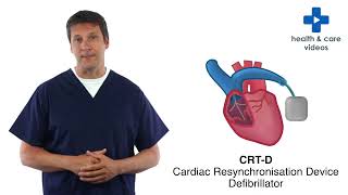 What is an Implantable Cardioverter Defibrillator ICD [upl. by Eevets]