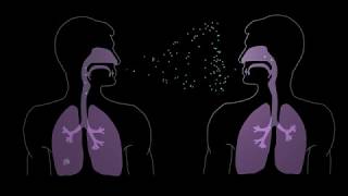 How Tuberculosis Begins [upl. by Neih761]