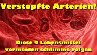 Verstopfte Arterien Vermeide schlimme Folgen mit diesen 9 Lebensmitteln [upl. by Primalia594]