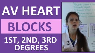 How to Interpret AV Heart Blocks Ekg Heart Rhythms  1st degree 2nd degree 3rd degree difference [upl. by Ainollopa]