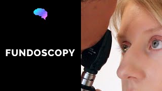 Fundoscopy Ophthalmoscopy  OSCE Guide  UKMLA  CPSA [upl. by Schell]