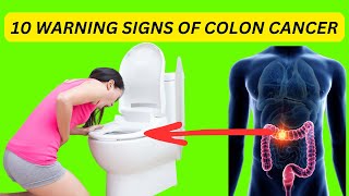 EARLY WARNING SIGNS OF COLON CANCER YOU SHOULD NOT IGNORE [upl. by Bahe]