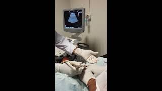 Emergency Ultrasound Guided Percutaneous Nephrostomy Tube placement [upl. by Aehsrop583]