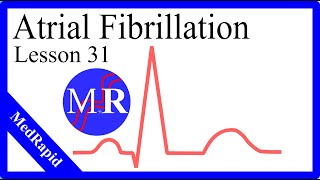 Atrial Fibrillation [upl. by Rofotsirk]