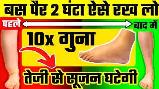 पैरों की सूजन घटाने का चमत्कारी उपायLeg Swelling TreatmentSciatica Pain Relief Exercises [upl. by Heater]