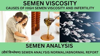 VISCOSITY OF SEMEN [upl. by Nylodam]