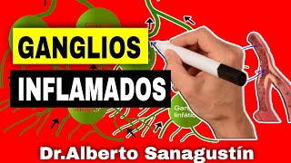 Signos PELIGROSOS en GANGLIOS LINFÁTICOS INFLAMADOS Adenopatías [upl. by Ycniuqal]