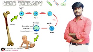 Gene therapy  ADA deficiency  MAGESHBIOLOGY [upl. by Ahsikin]