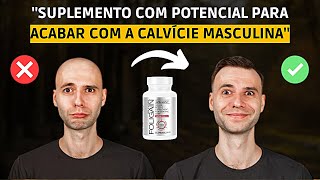 FOLIGAIN E CALVÍCIE MASCULINA [upl. by Strawn]